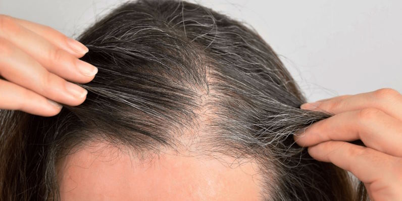 hair restoration treatments